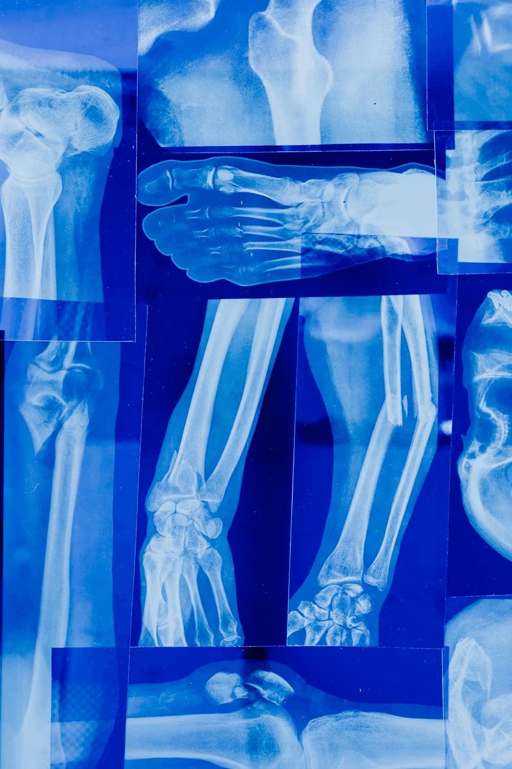 <strong>Skin Cancer Clinical Negligence Claims:</strong> A Practical Guide to Delay and Causation