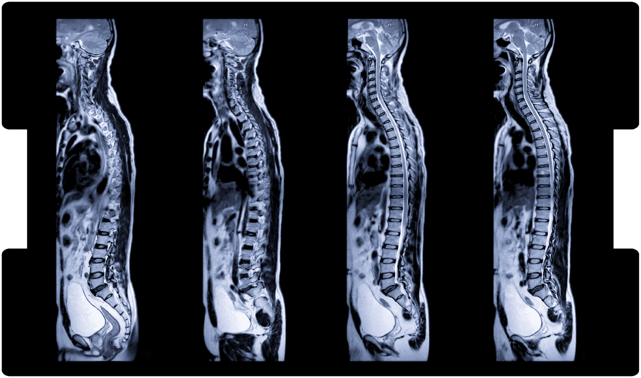 CES-expert-witness-webinar-INNEG