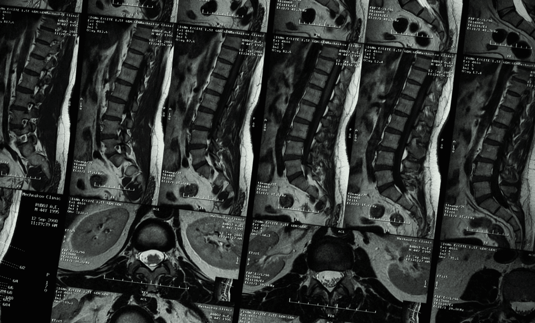 INNEG-MRI-SPINAL-PAIN-HEADER