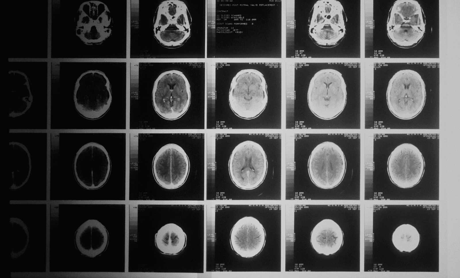 paediatric-brain-injury-webinar