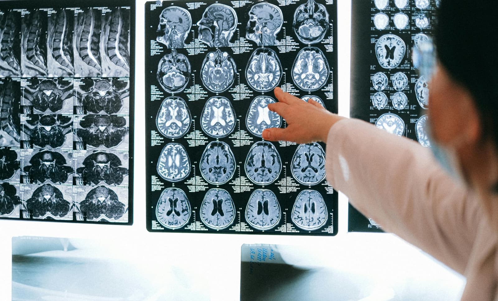 brain-tumor-INNEG-solicitor-medicolegal.jpg