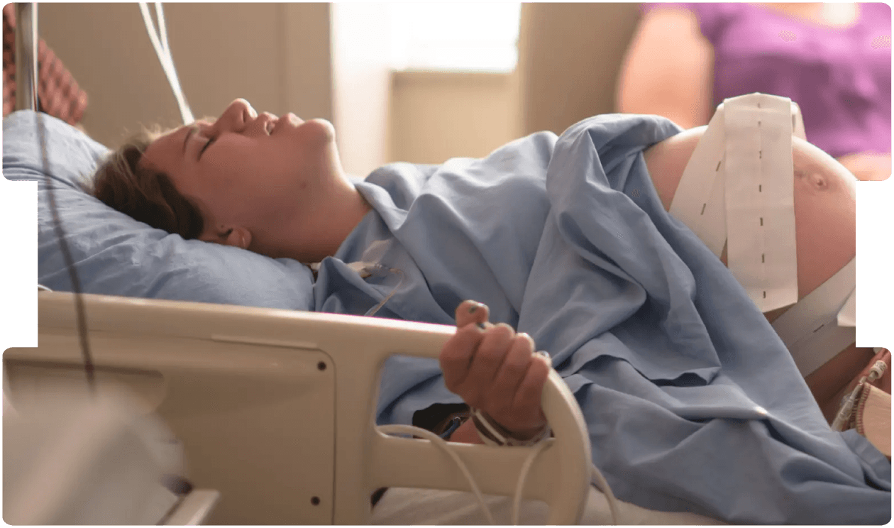 Woman in labour monitored in hospital, illustrating the challenges and medico-legal considerations of managing breech delivery cases.