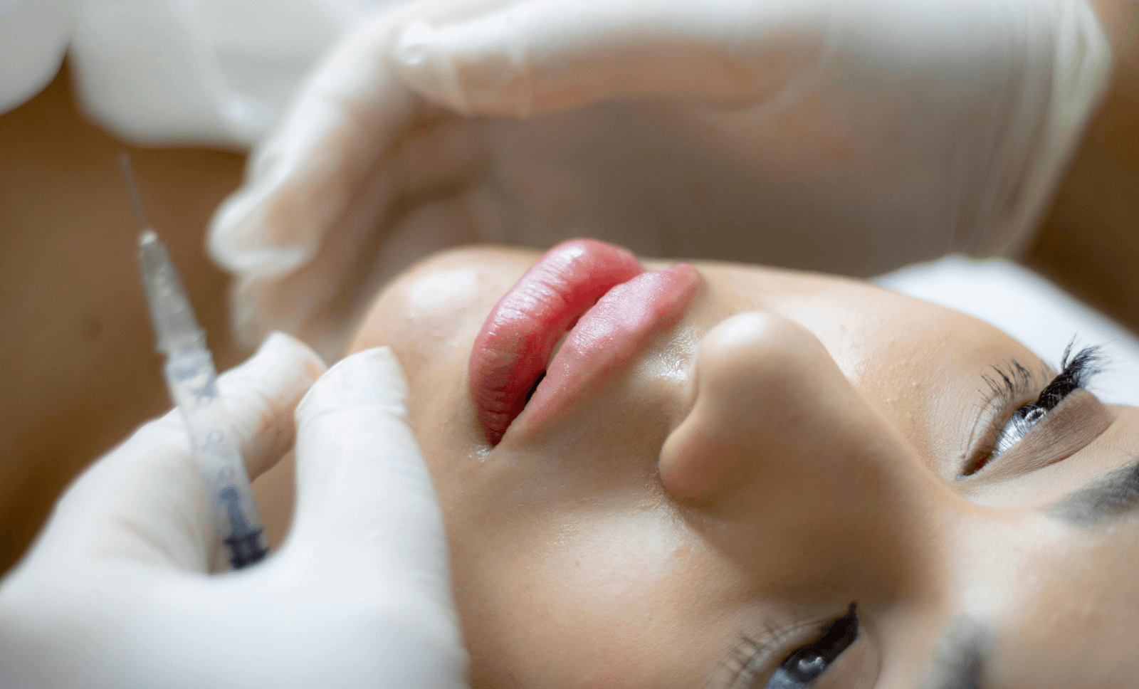 lip-filler-cosmetic-aesthetic-treatment