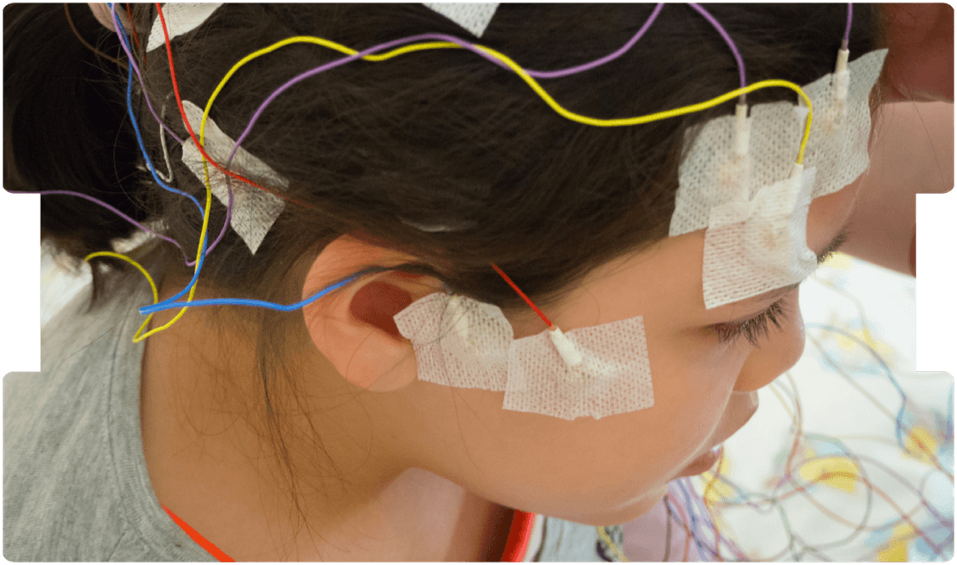 epilepsy-and-seizures-expert-witness-header