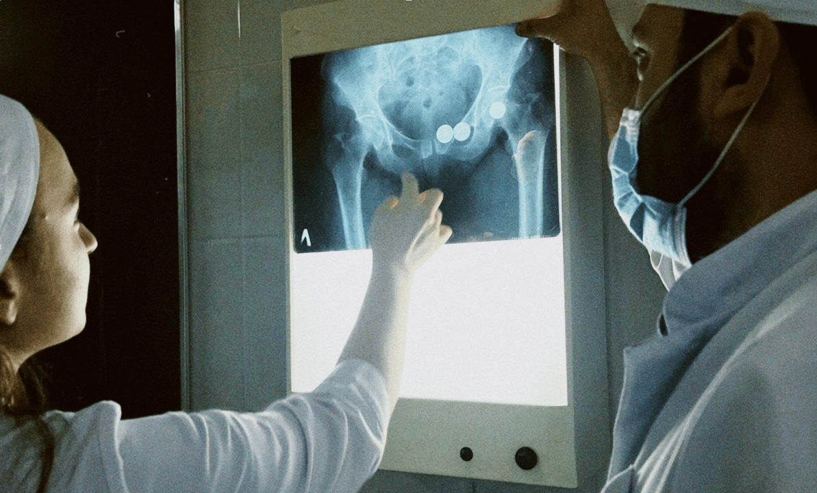 hip-scan-xray-clinical-negligence