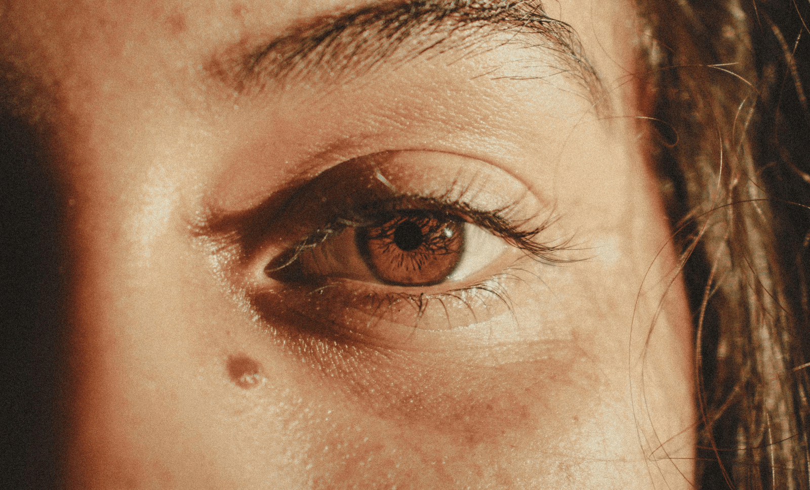 up-close-eye-image-with-mole