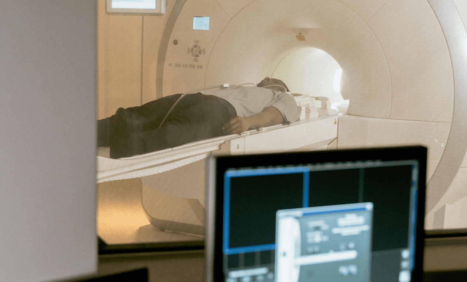 mri-scan-traumatic-brain-injury-epilepsy