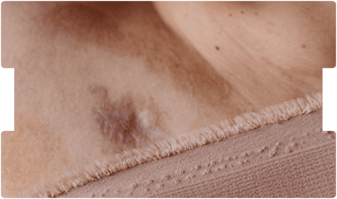 oncology-expert-witness-skin-cancer-imagery