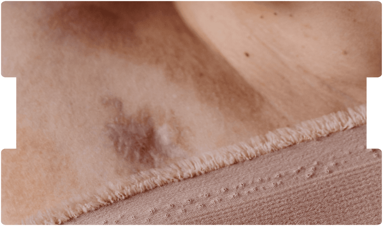 oncology-expert-witness-skin-cancer-imagery