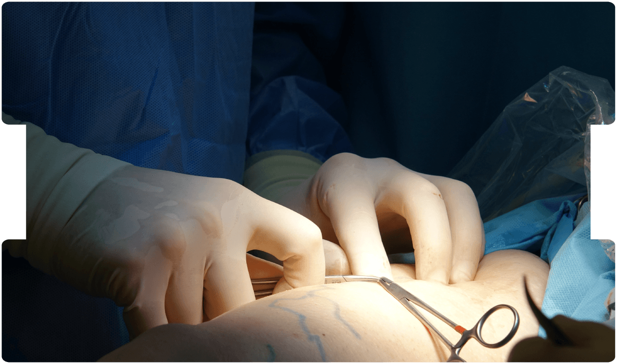 oncoplastic-expert-witness-inneg