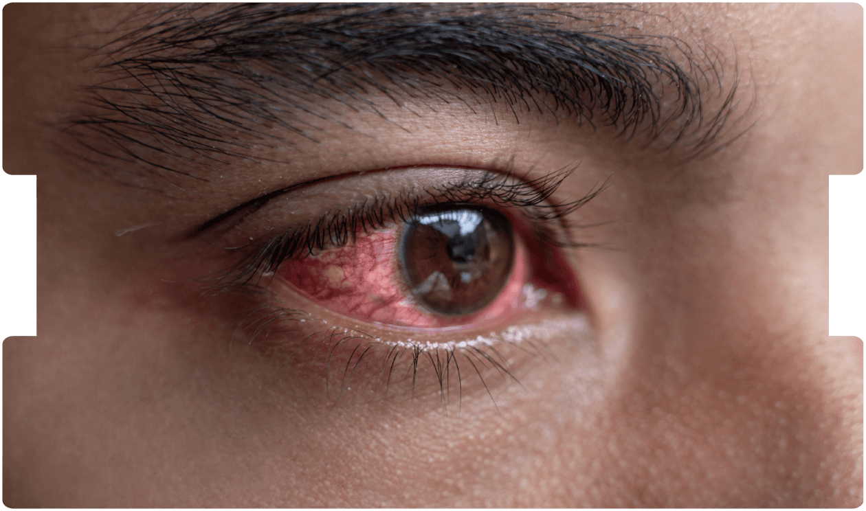 optometrist-expert-witness-blog-inneg