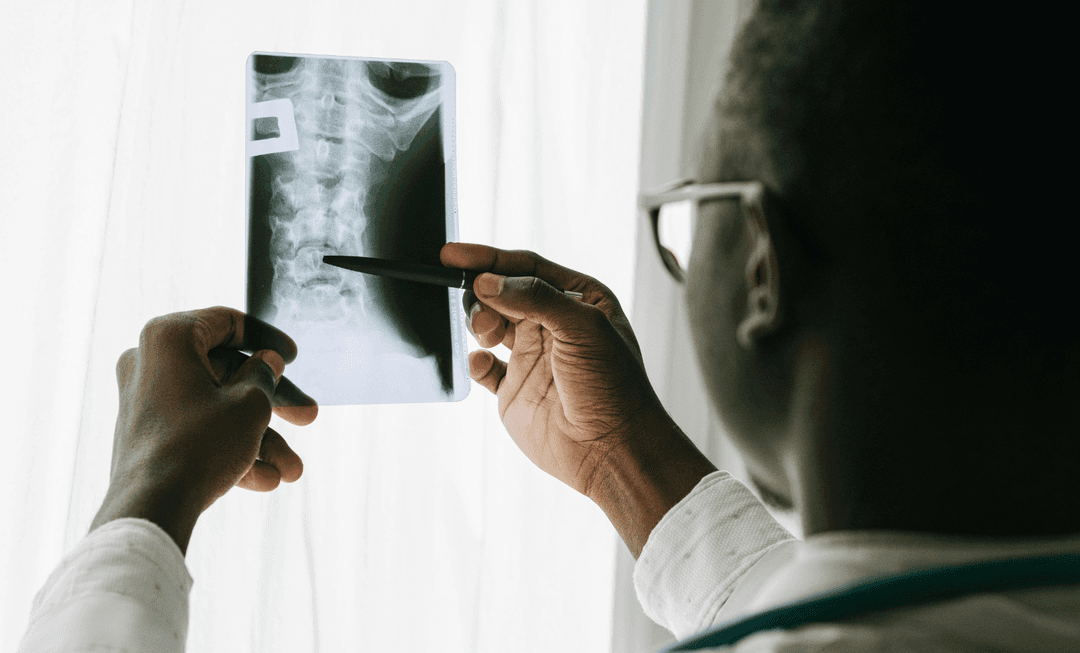 Doctor examining a spinal X-ray, highlighting the critical role of orthotics in rehabilitation and spinal injury management.
