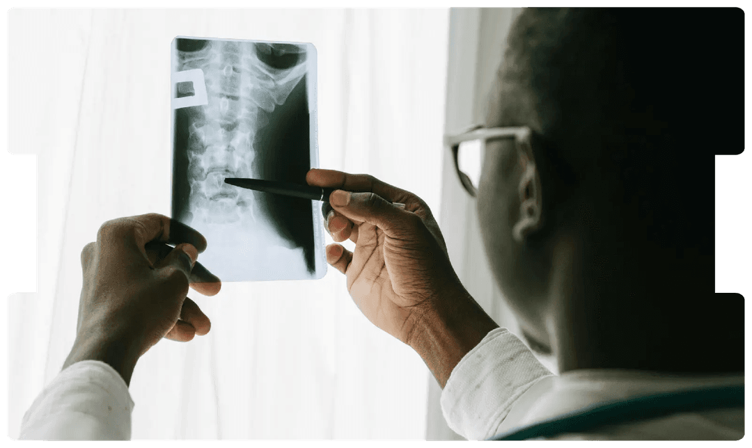 Doctor examining a spinal X-ray, highlighting the critical role of orthotics in rehabilitation and spinal injury management.
