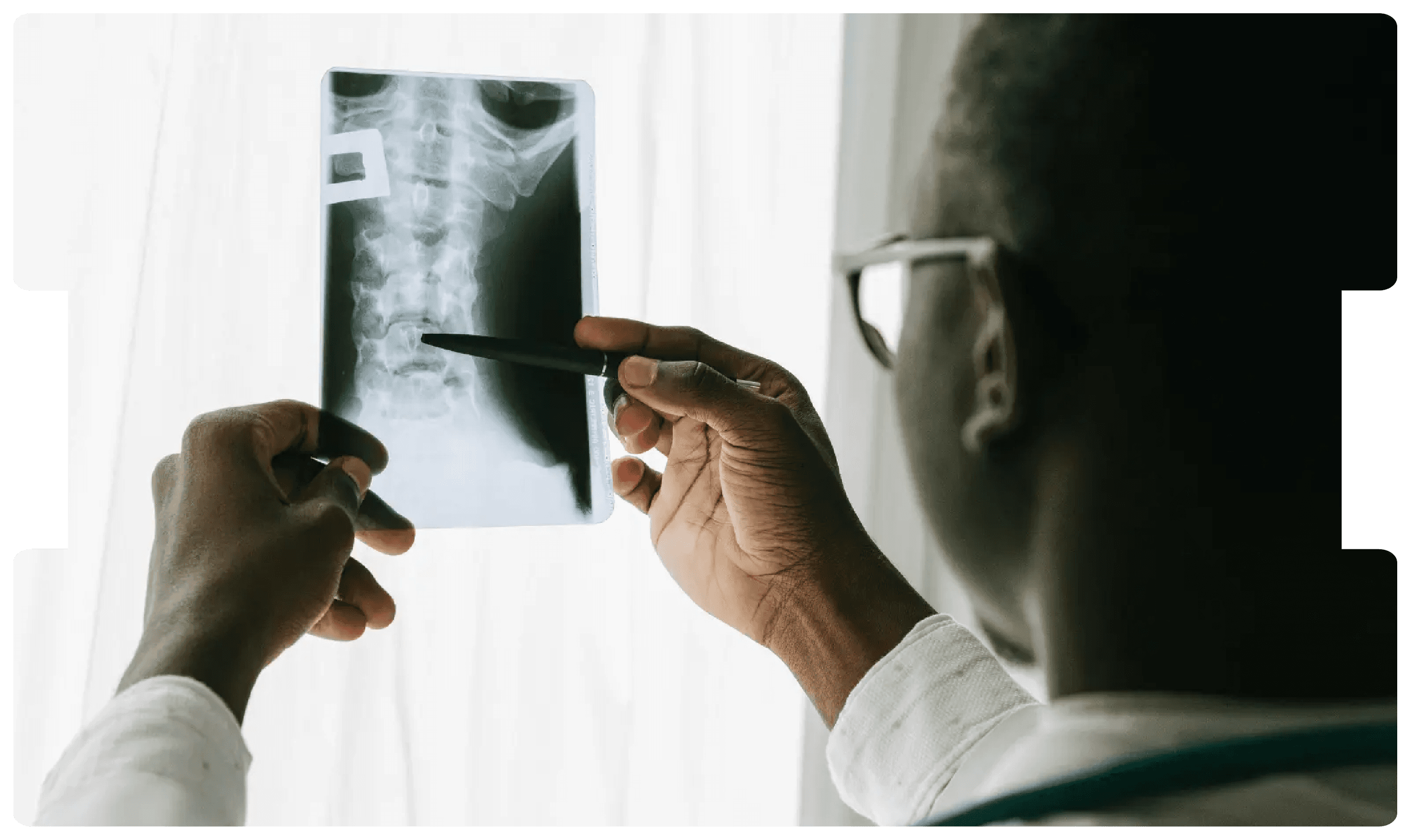 Doctor examining a spinal X-ray, highlighting the critical role of orthotics in rehabilitation and spinal injury management.