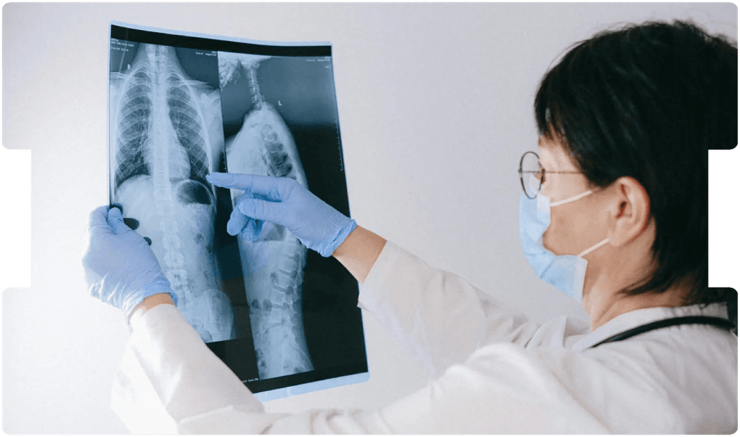Doctor examining spinal X-rays, representing evaluation and treatment planning for paediatric spinal surgery.