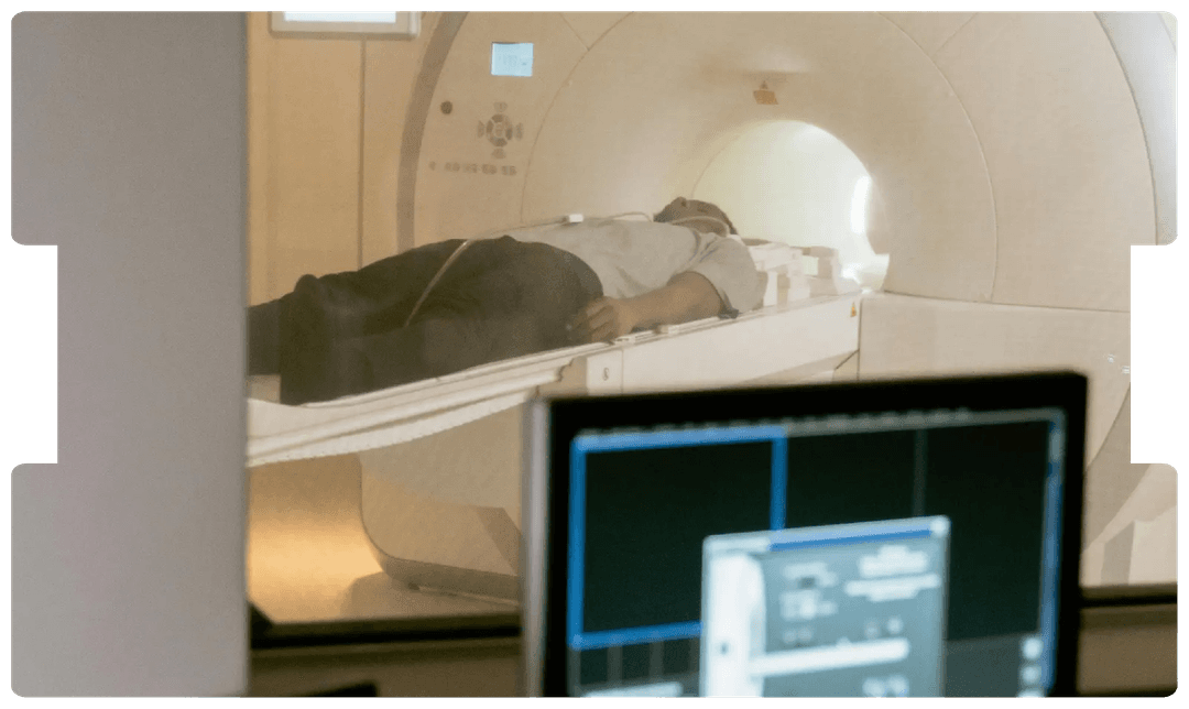 Patient undergoing an MRI scan, representing the diagnostic process and medico-legal considerations in post-traumatic epilepsy cases.