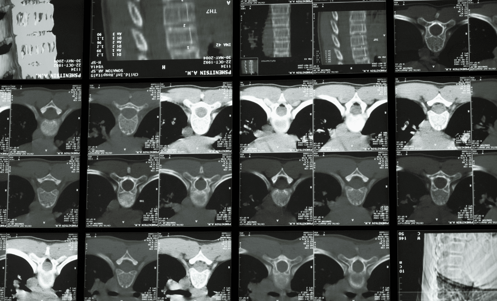 examination-of-the-spine-INNEG