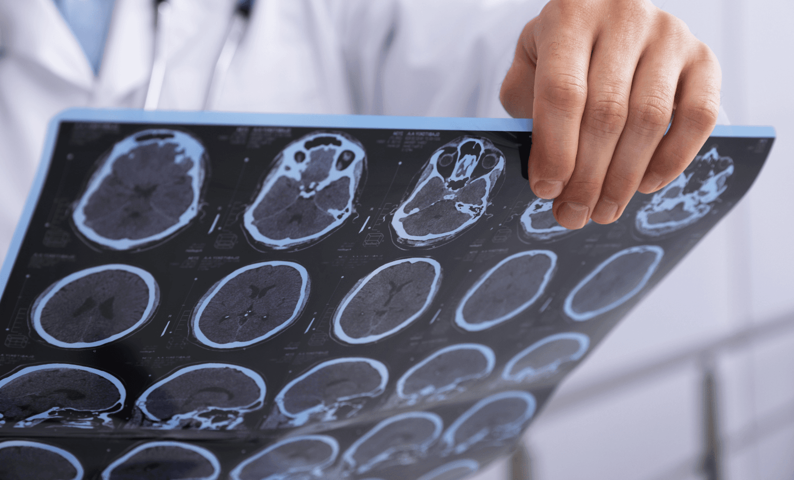 Doctor examining detailed brain scan images on a radiology film, assessing neurological health and MRI diagnostic results.