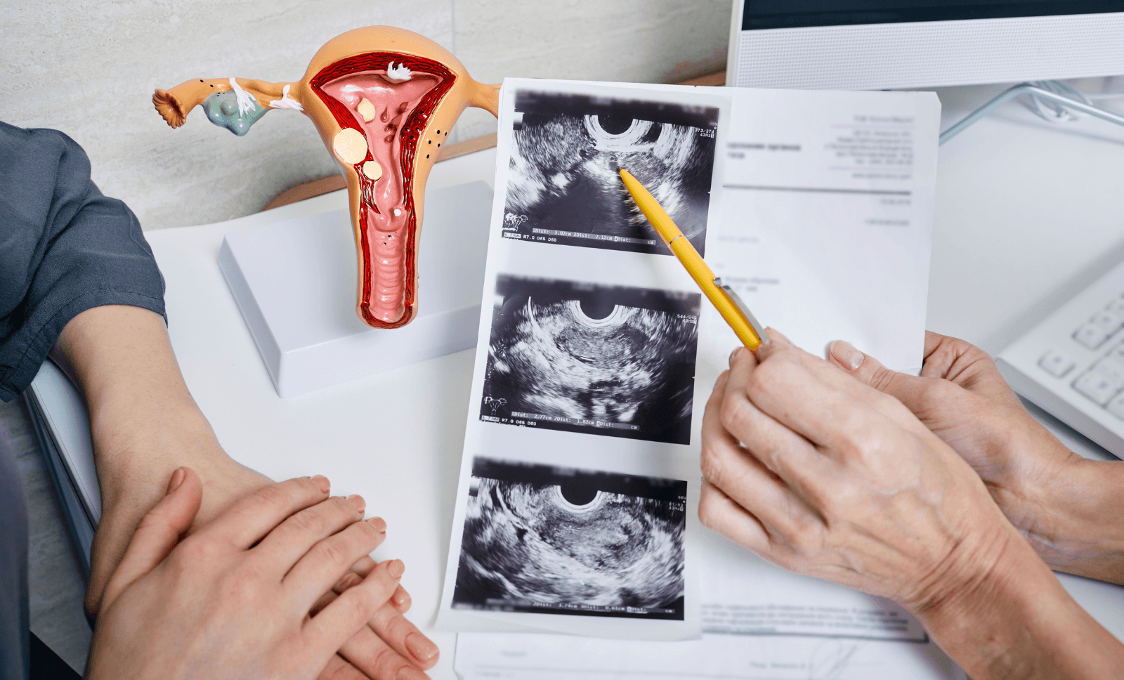 INNEG-gynaecology-ovarian-cancer-litigation-expert-witness