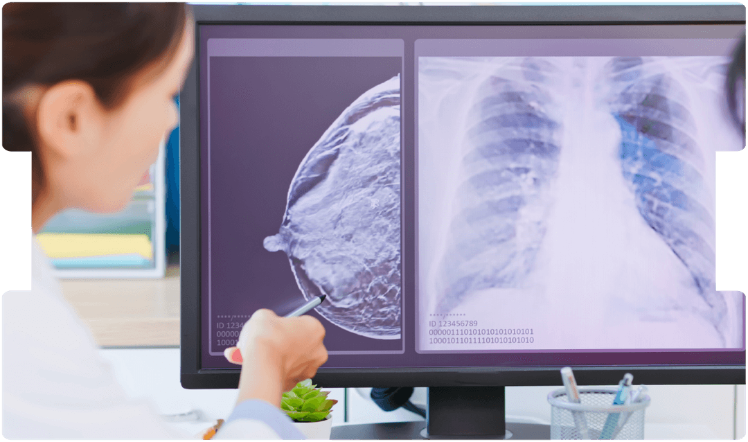 breast-cancer-oncology-expert-witness-V2