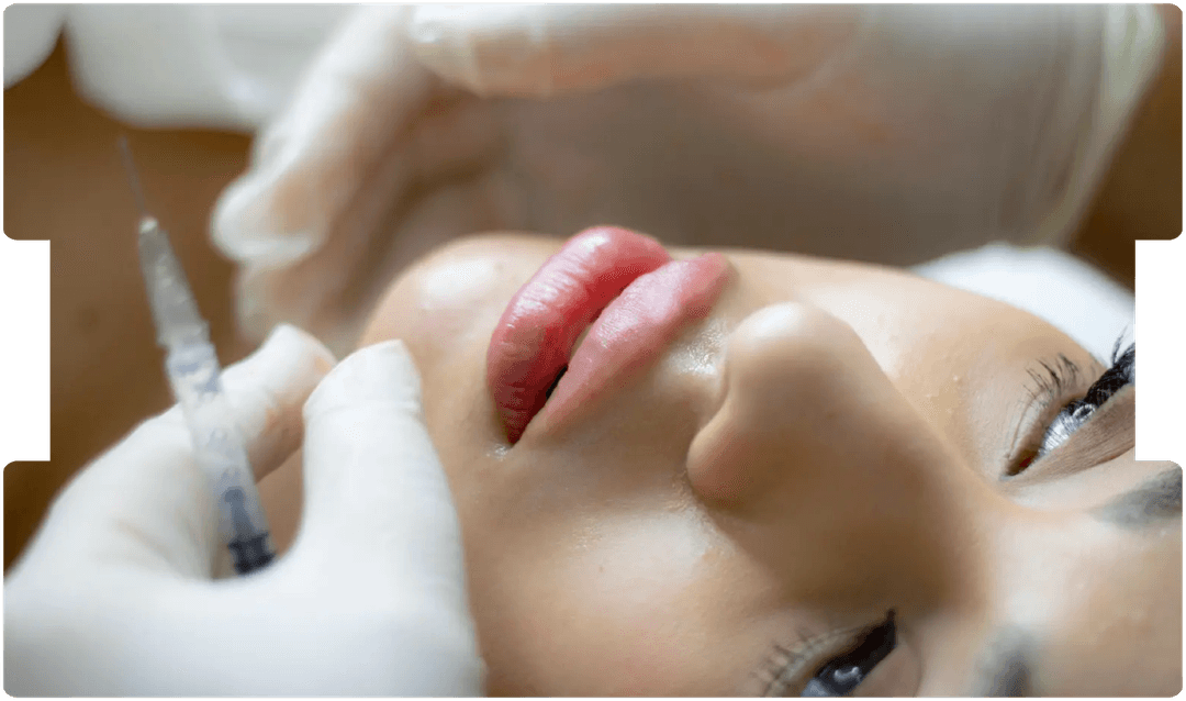 Close-up of a patient receiving a cosmetic injection, highlighting the importance of informed consent and ethics in aesthetic medicine.