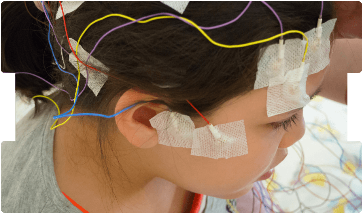 epilepsy-and-seizures-expert-witness-header