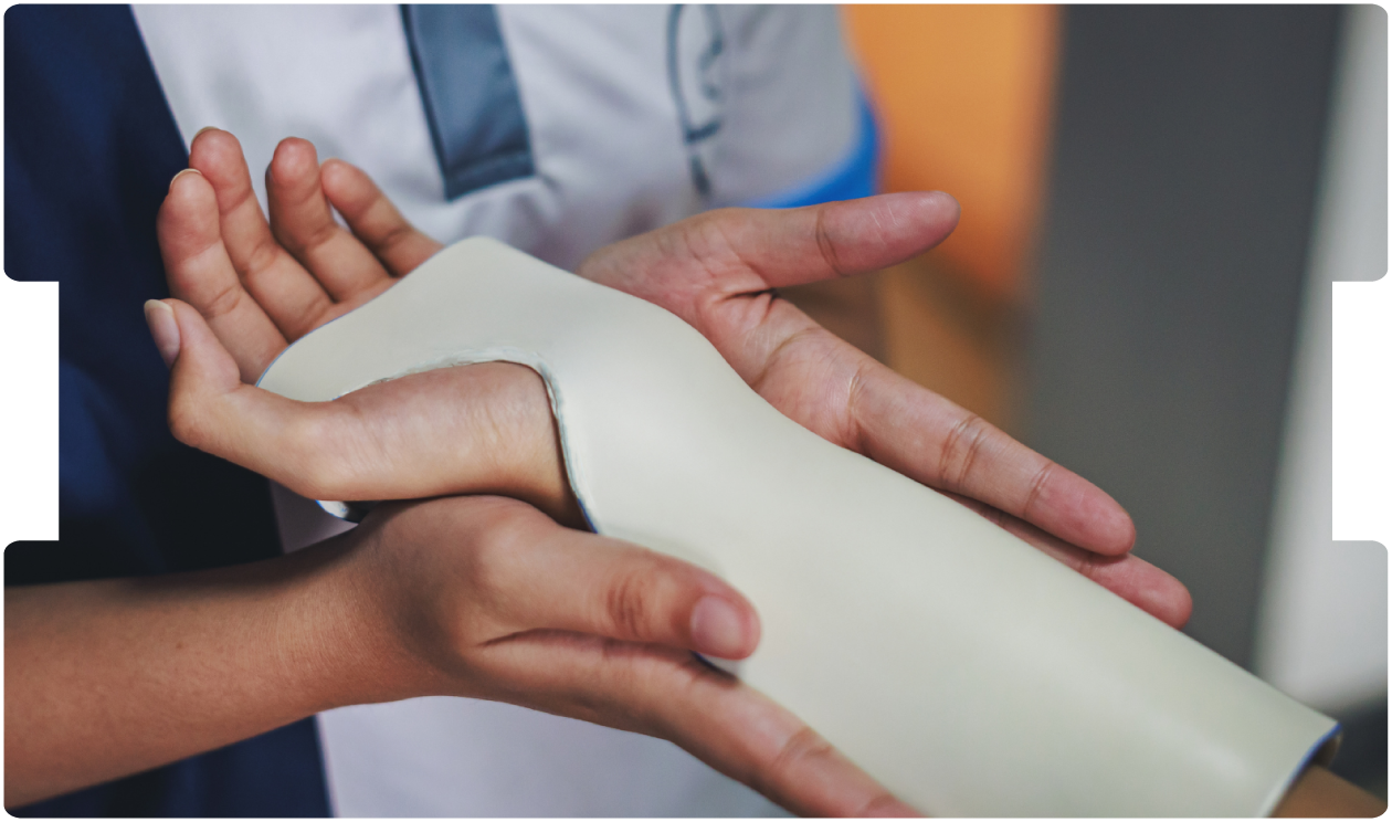 Healthcare professional fitting a wrist and hand splint on a patient during hand trauma treatment.