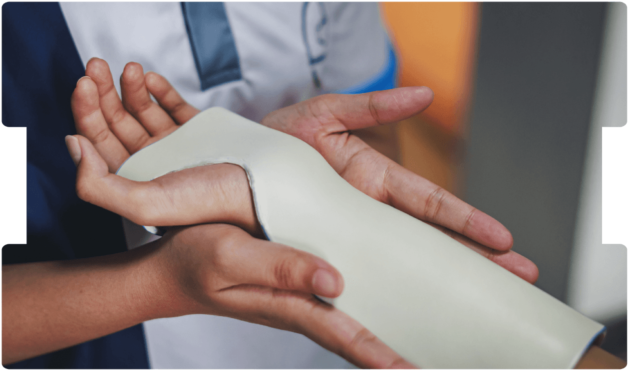 Healthcare professional fitting a wrist and hand splint on a patient during hand trauma treatment.