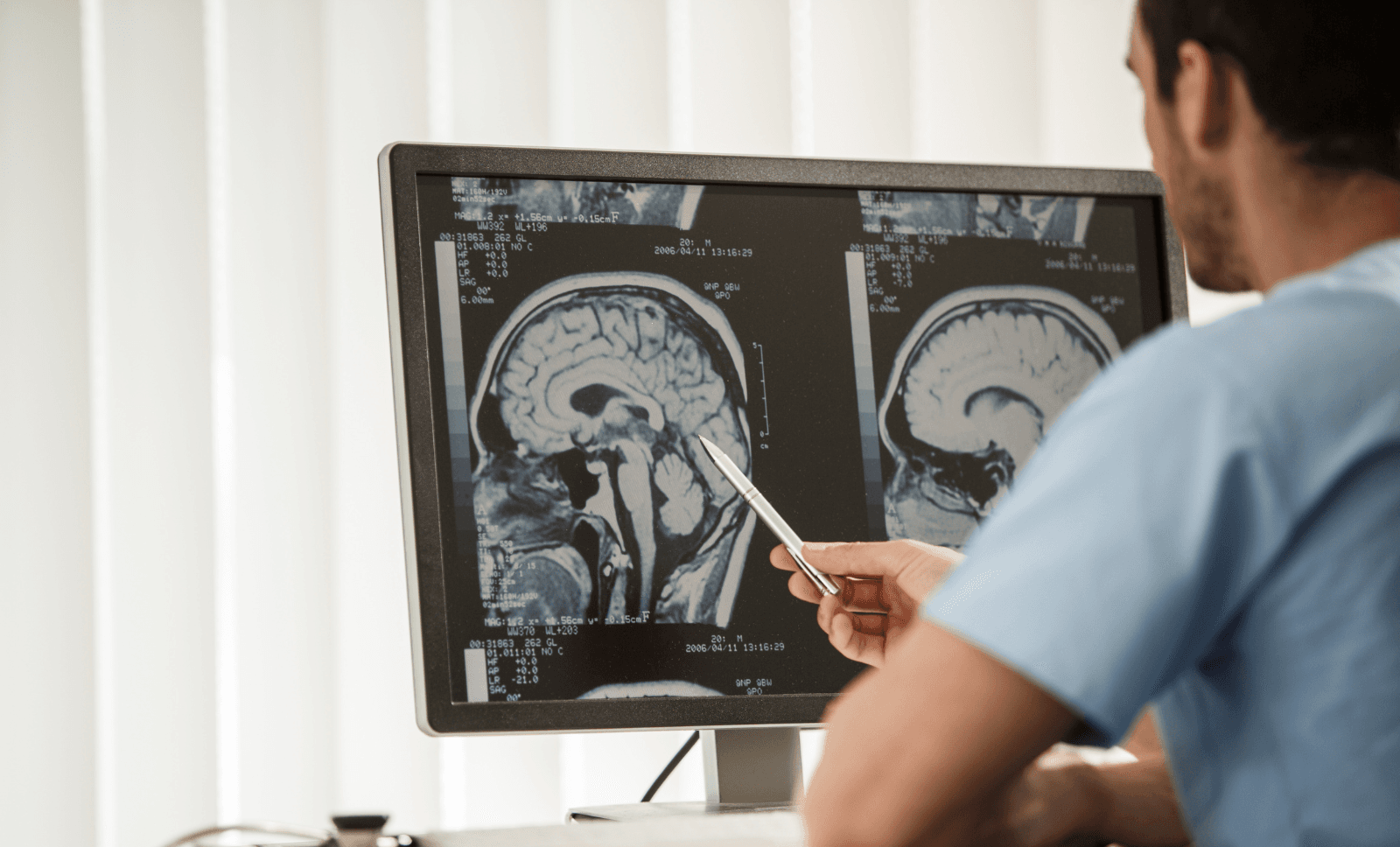 neurology-expert-witness-doctor-brain-scan-neuro-oncology