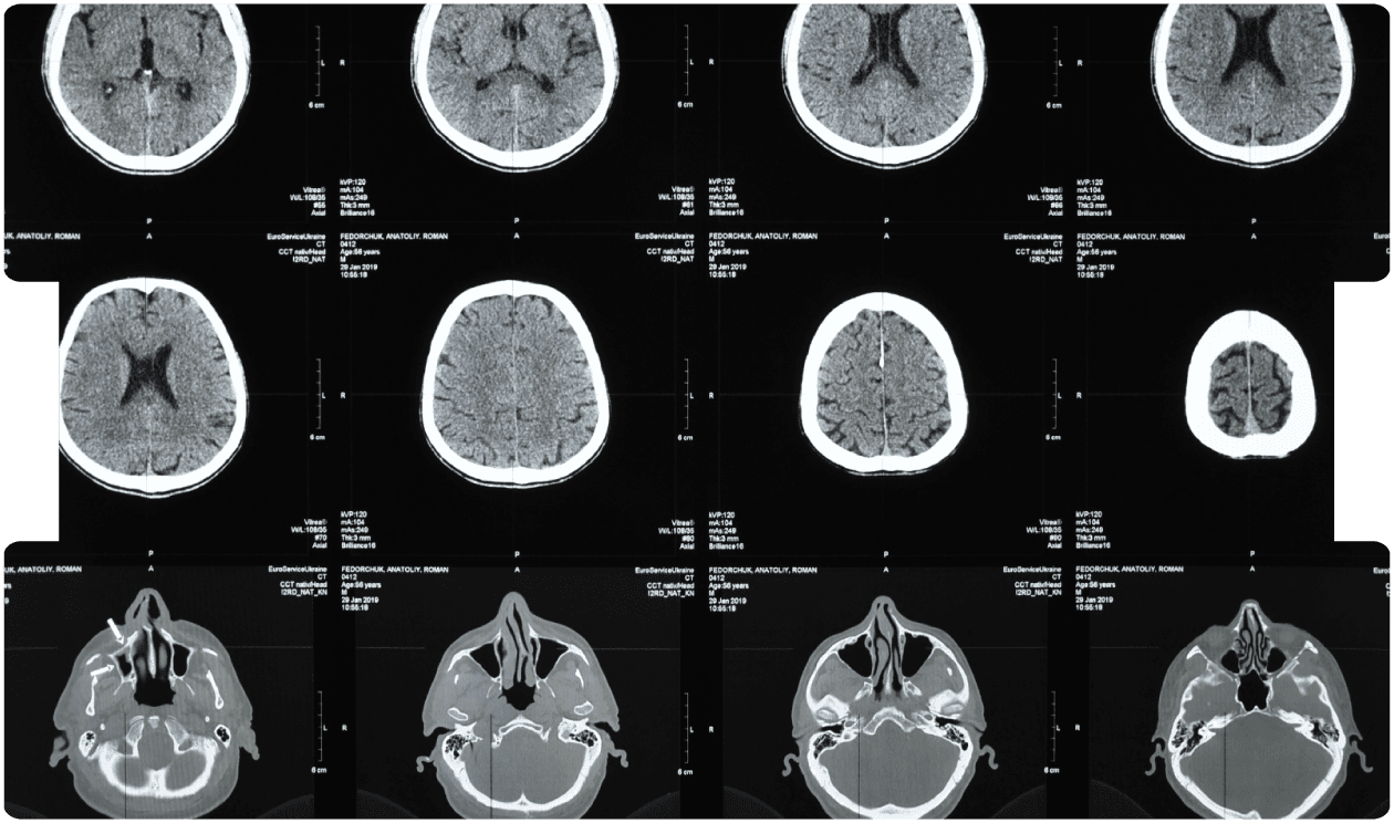 neurospychological-header-blog-expert-witness