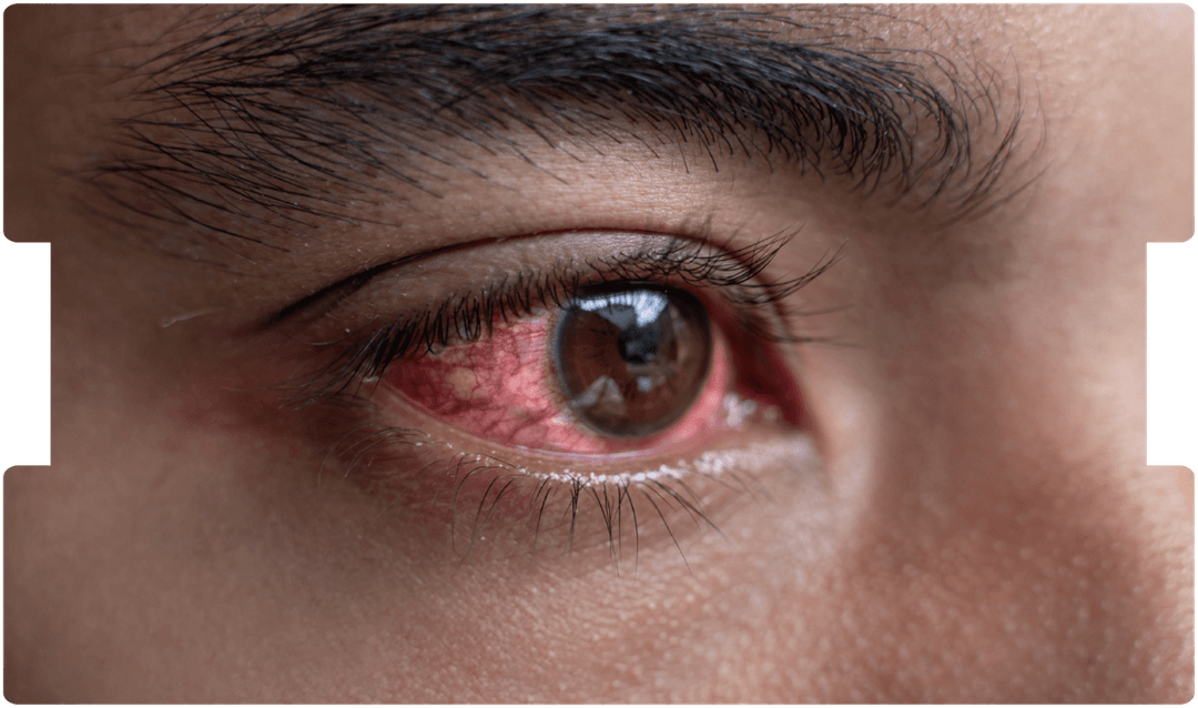optometrist-expert-witness-blog-inneg