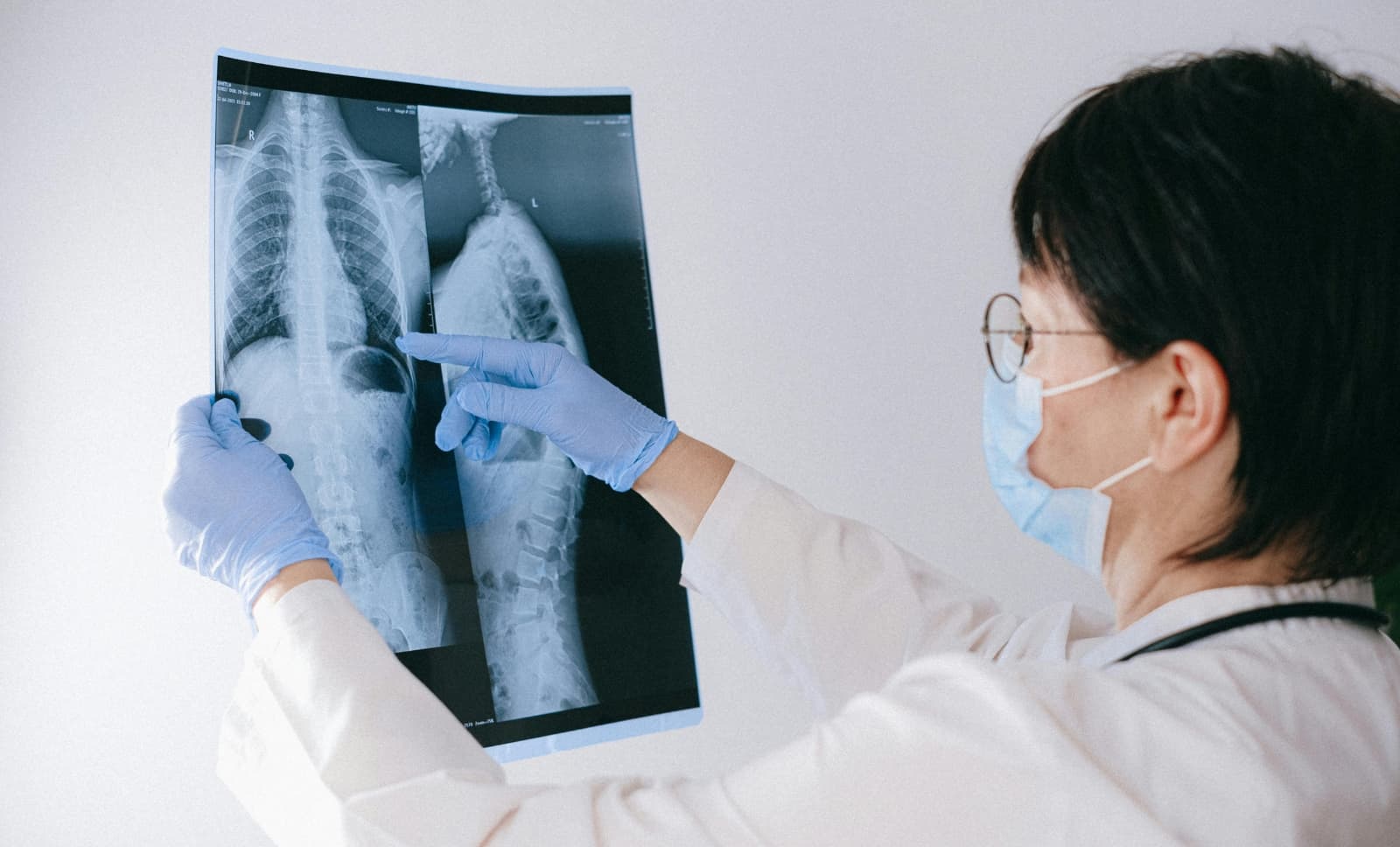 paediatric_spinal_surgery_legalinsights_medicolegal_inneg.jpg