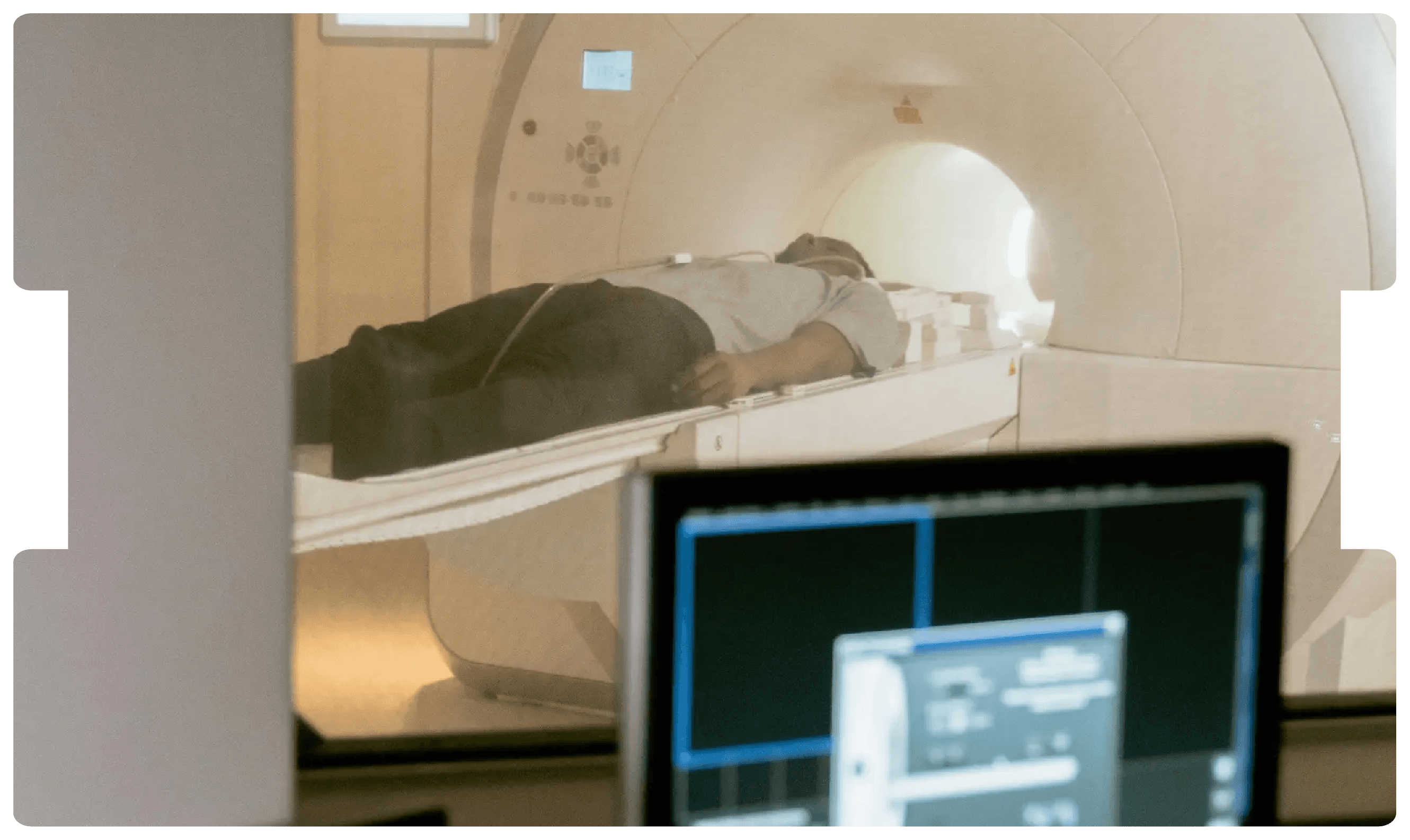 Patient undergoing an MRI scan, representing the diagnostic process and medico-legal considerations in post-traumatic epilepsy cases.