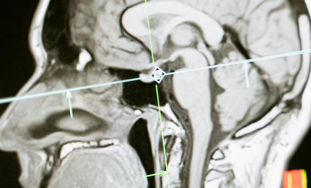 Detailed brain MRI scan highlighting precision imaging, underscoring the radiographer’s expert witness role in medico-legal investigations.