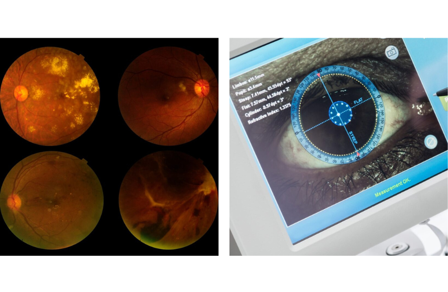 Medico-Legal Aspects of Paediatric Cerebral Visual Impairment.png